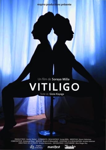 Poster of Vitiligo