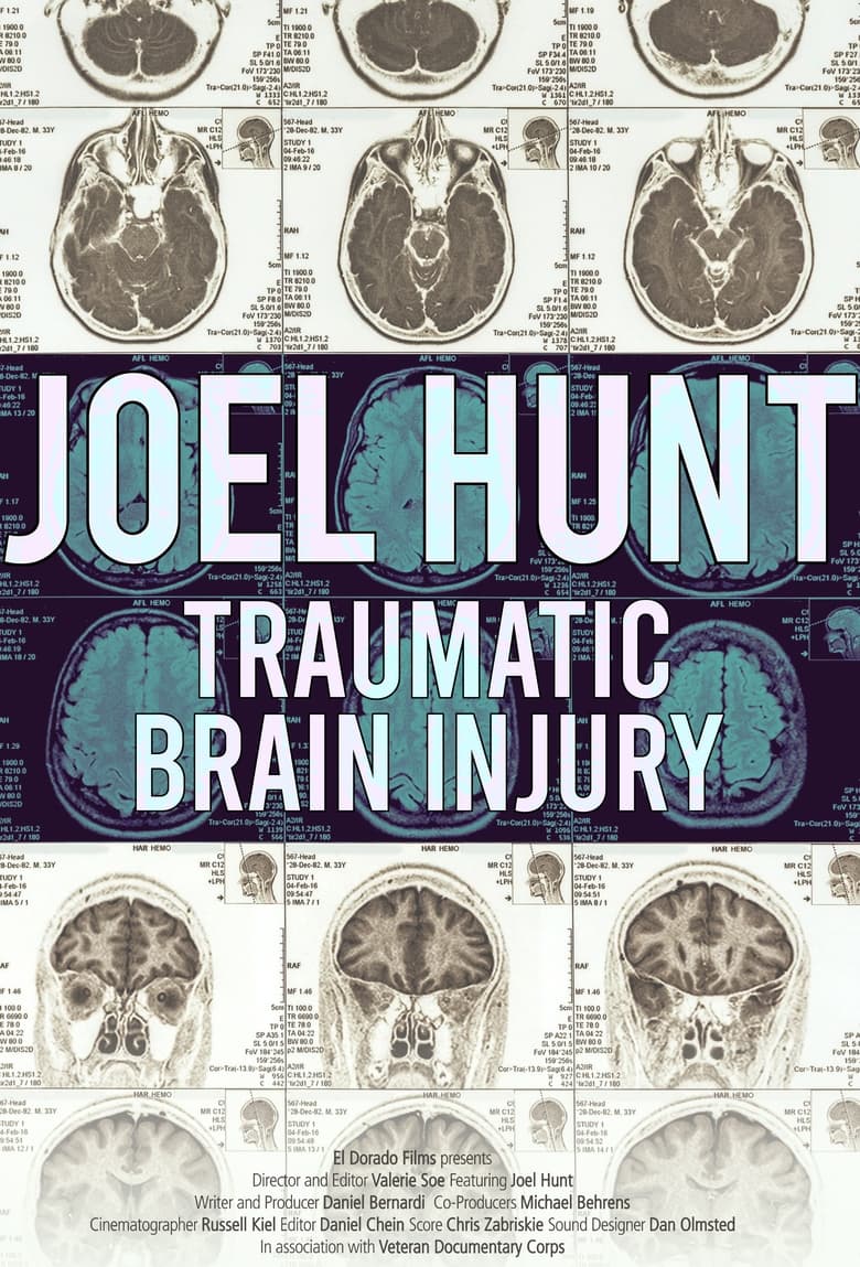 Poster of Joel Hunt: Traumatic Brain Injury (TBI)