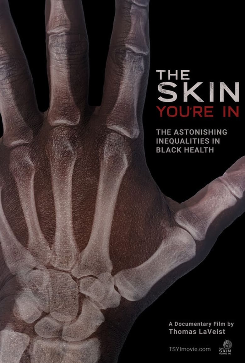 Poster of The Skin You’re In