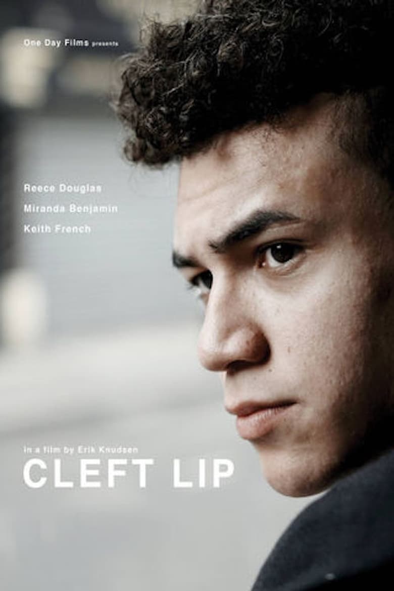 Poster of Cleft Lip